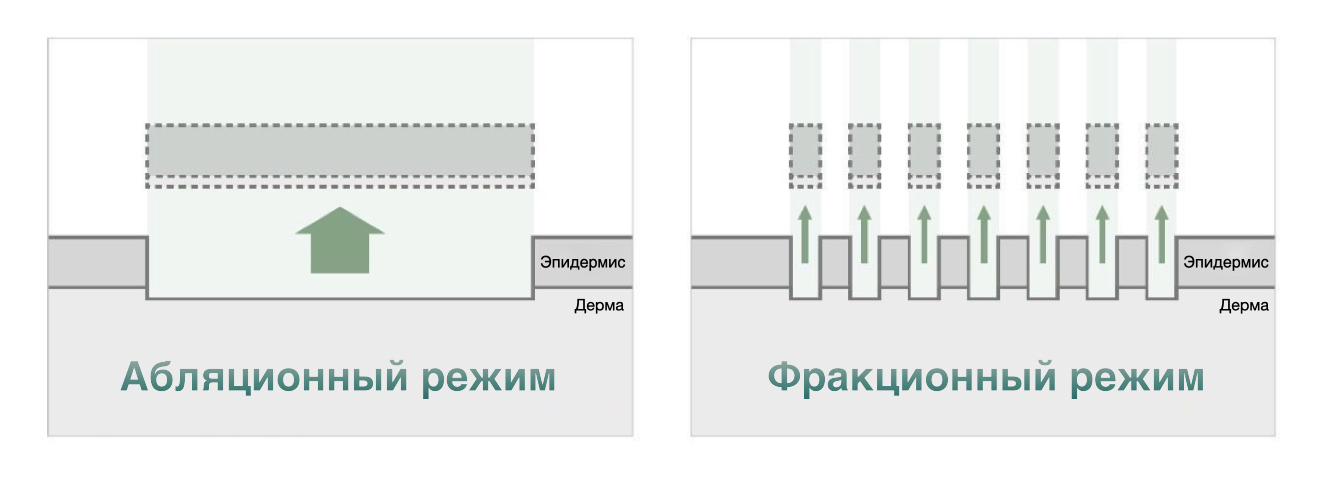 Asclepion MultiPulse PRO ➜ Профессиональный CO2 лазер в Украине | Alfaspa изображение 50
